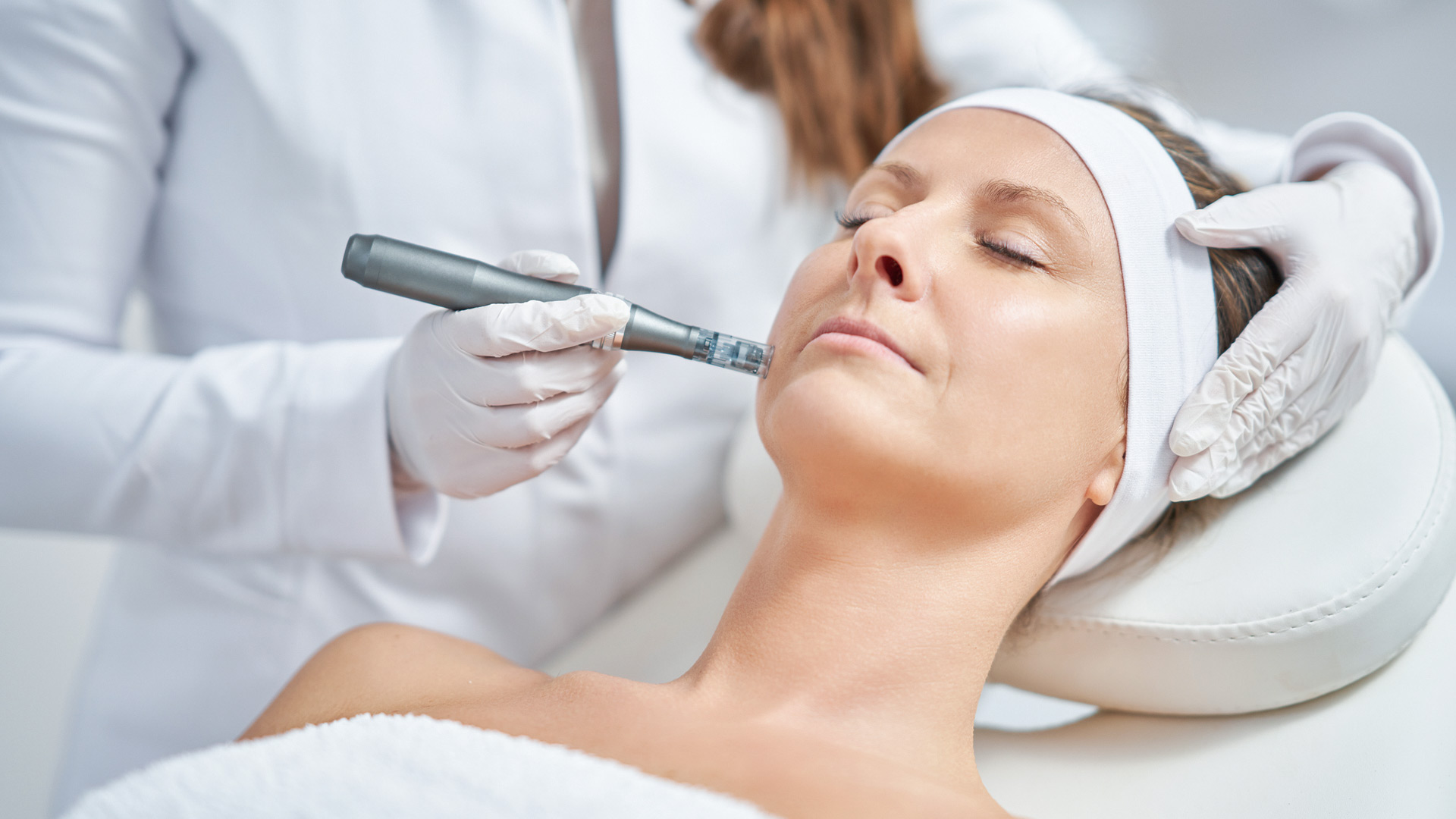 Microneedling